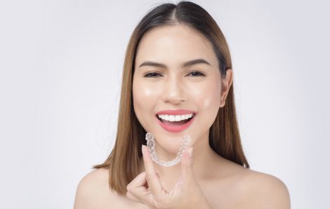 What Are the 9 Benefits of Getting Invisalign?