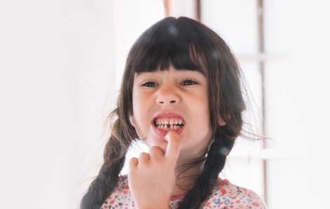 What Is the Most Updated Method for Replacing a Missing Tooth?